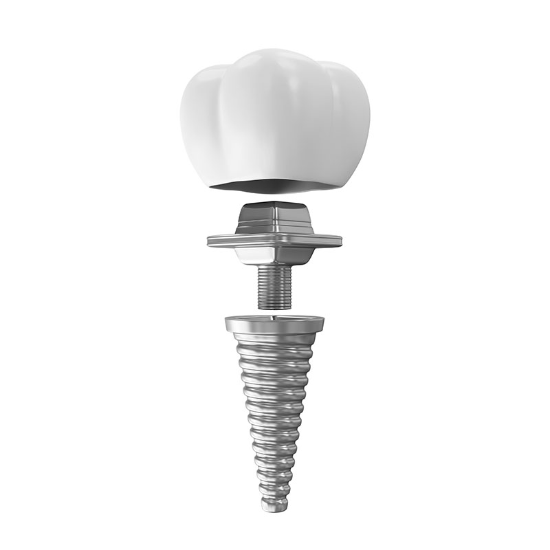 無翻瓣微創植牙