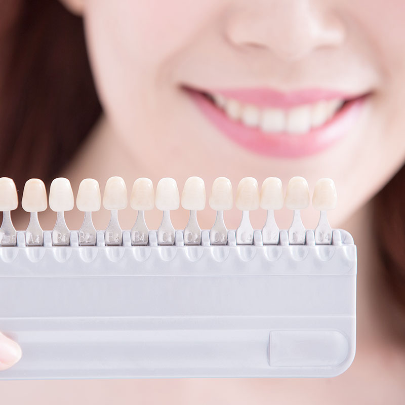 客製化微笑設計