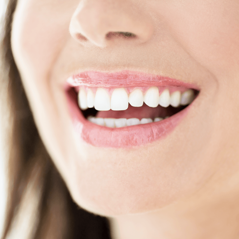 微創齒槽骨整形術